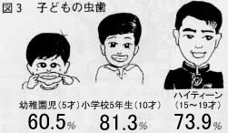 歯の健康　口の健康