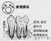 歯の健康　口の健康