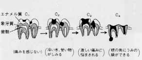 歯の健康　口の健康