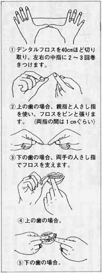 虫歯や歯周炎から歯を守るブラッシング